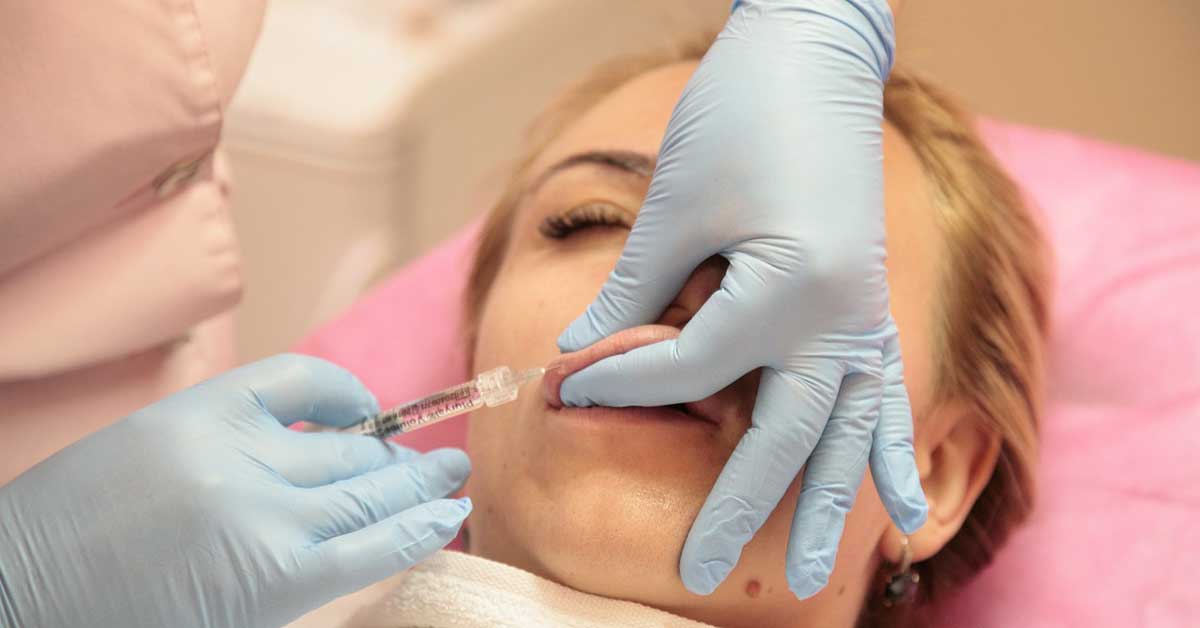 povećanje usana hijaluronom