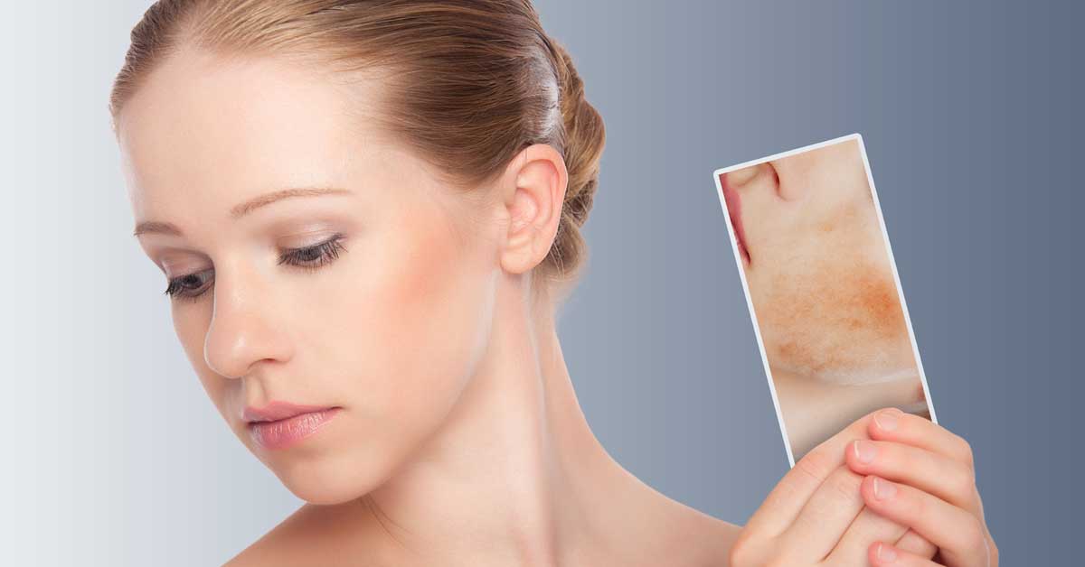 otok od bubuljice na licu