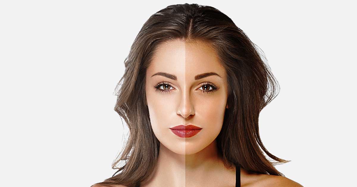 hidrohinon krema za lice