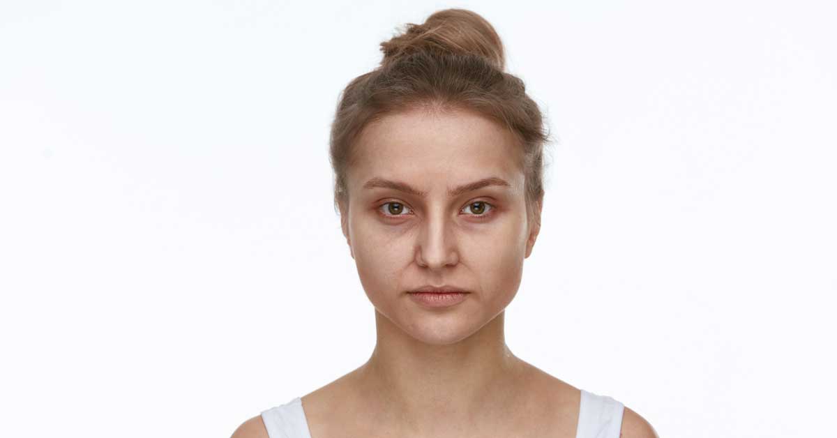  Kesice ispod očiju – koji su uzroci i kako izgleda lečenje