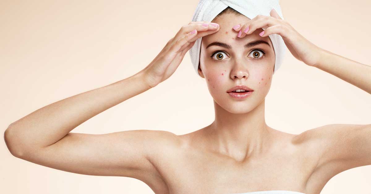 kako se rešiti bubuljica