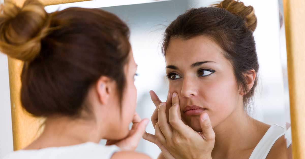  Šta je uzrok akni i bubuljica i kako ih sprečiti?