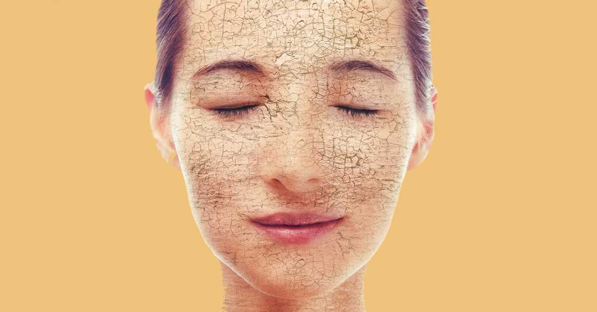  Nega suve kože lica treba da izgleda ovako!