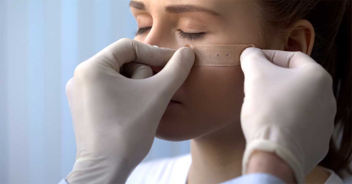 flaster za bubuljice