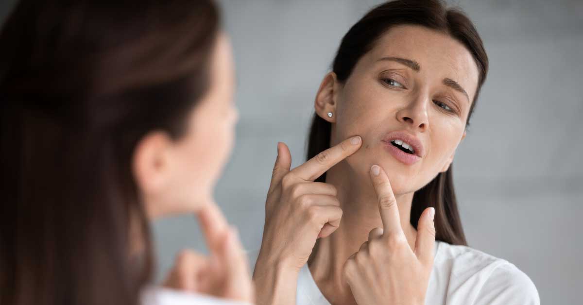 kako se rešiti mitisera