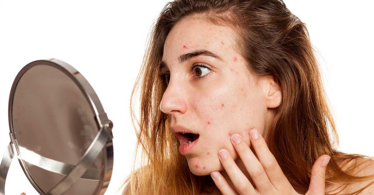 bubuljice na obrazima