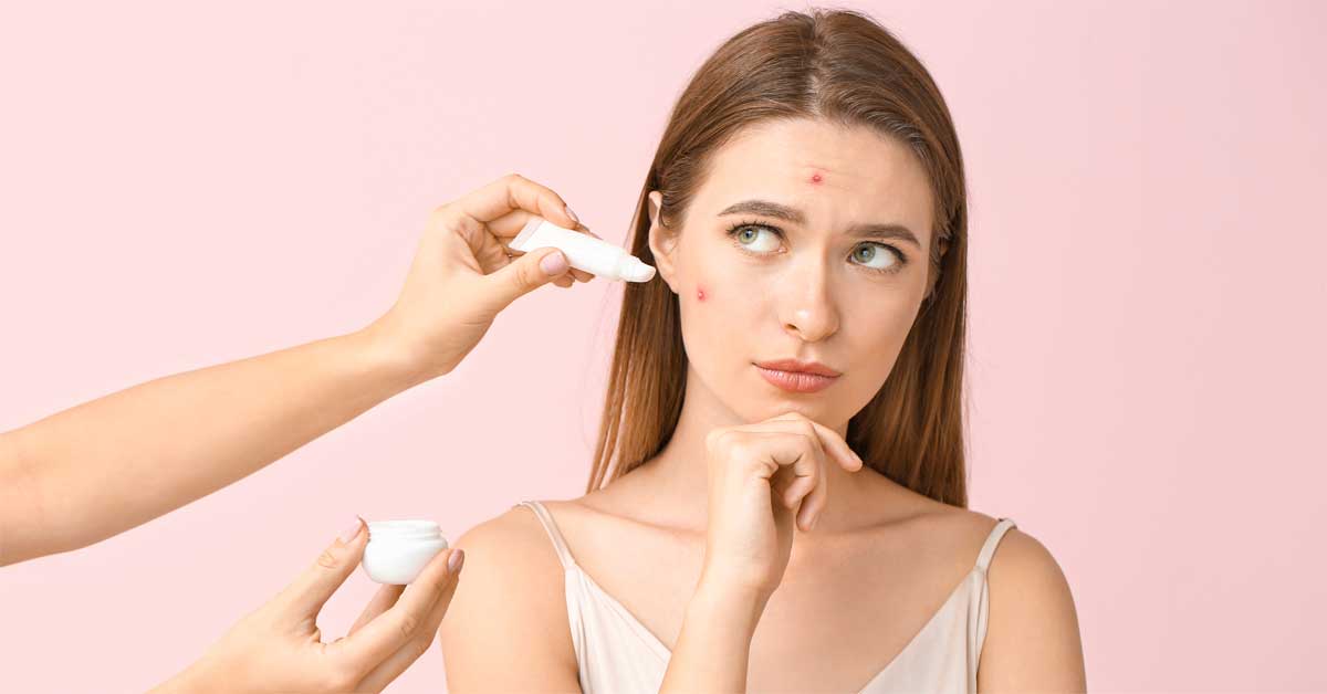  Da li je Airol krema za akne dobro rešenje za vaše lice?