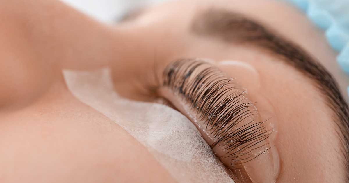  Minival trepavica – kako izgleda tretman i koja je cena?