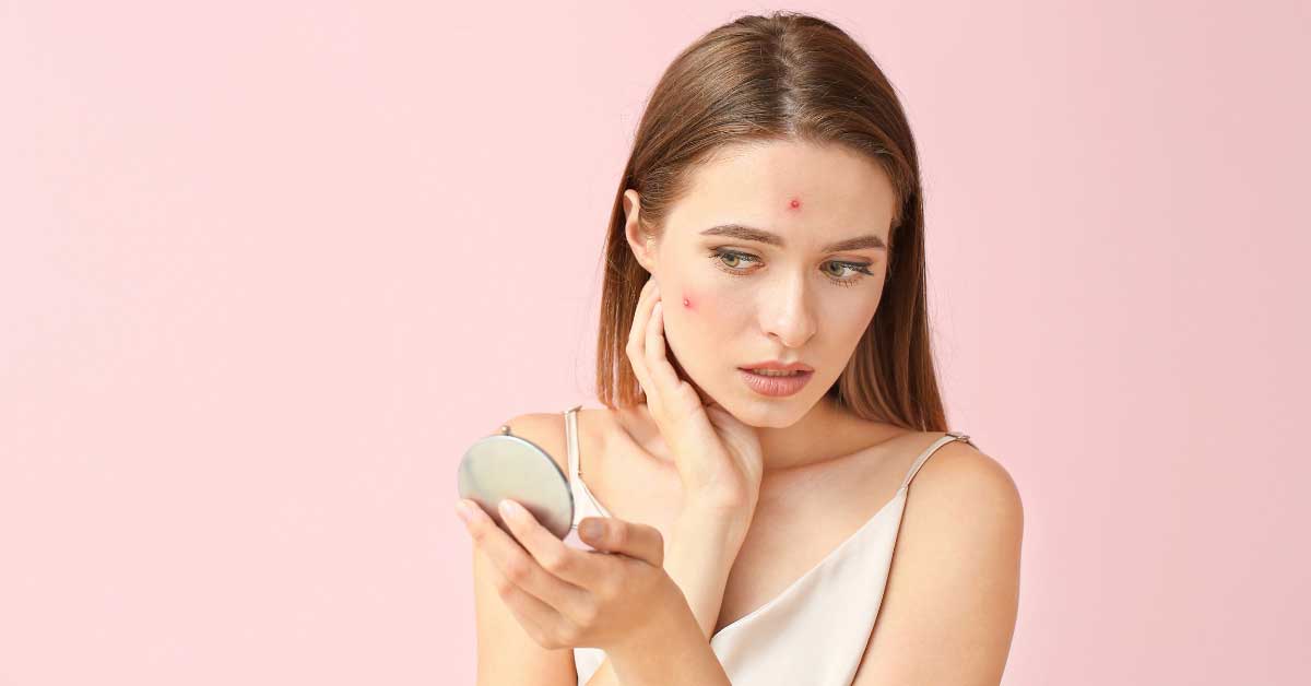  Bele bubuljice iščezavaju uz ove savete!