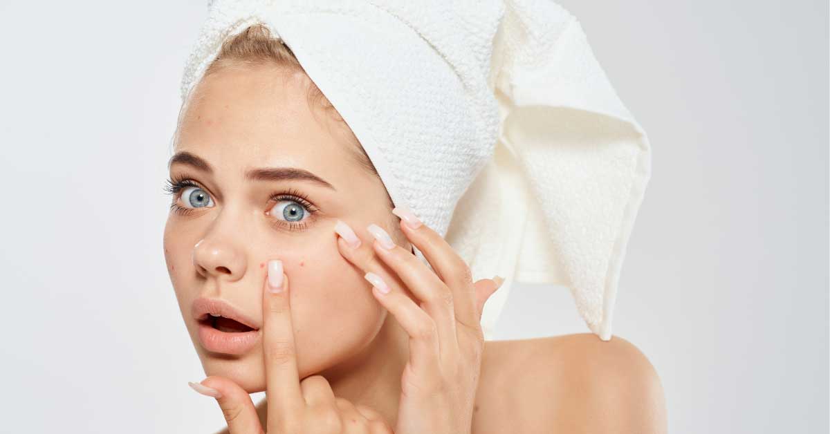  Proverite! Možda su to bubuljice od šampona na licu!