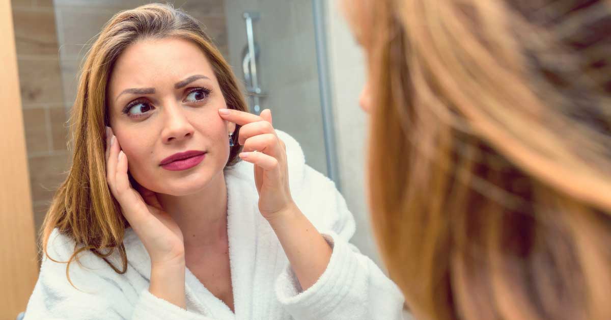 promene koje lice na akne