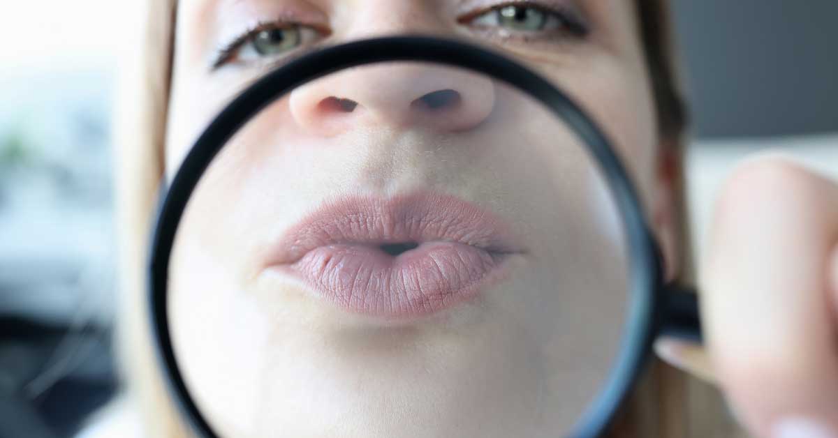  Povećanje usana: svi načini na jednom mestu!