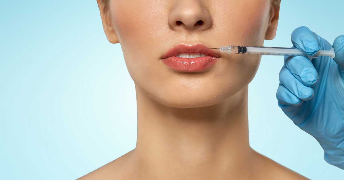  Korekcija usana – trend ili potreba?