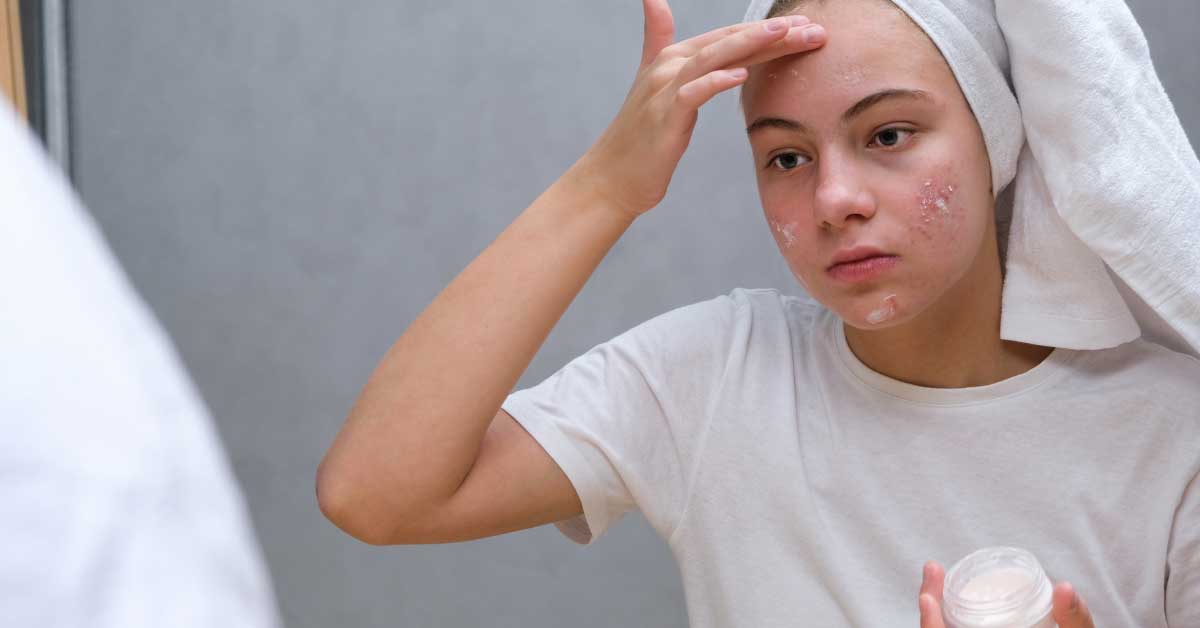 nega koze za tinejdžere