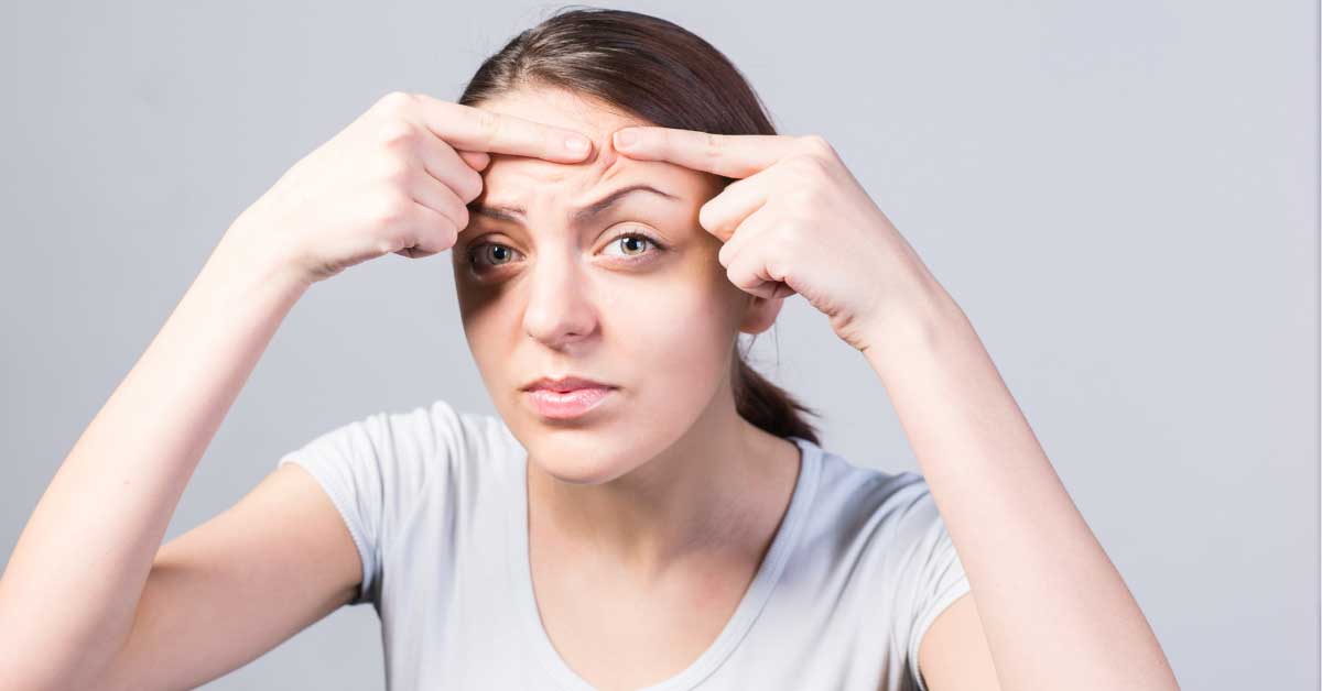  Mitiseri na čelu nisu nepobedivi!