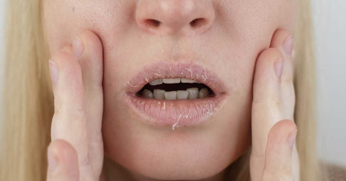  Suve usne ne moraju biti vaš problem uz ove savete